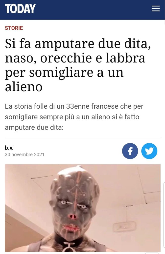 Si fa amputare due dita, naso, orecchie e labbra per somigliare a un alieno